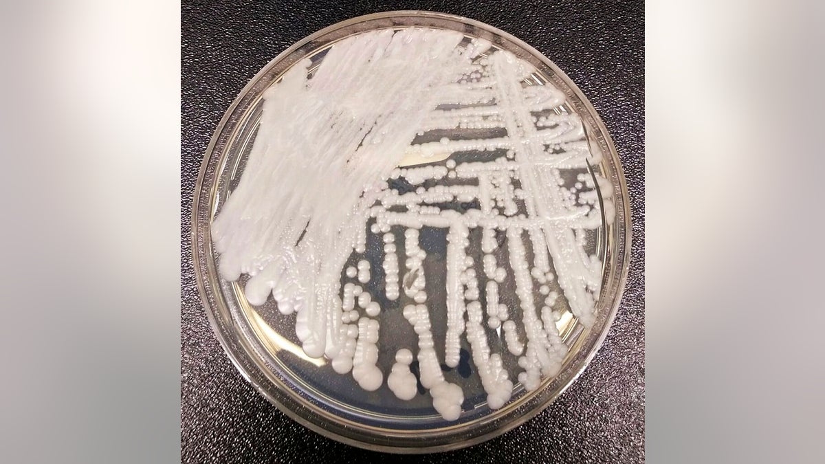 CDC superbug fungus in a petri dish