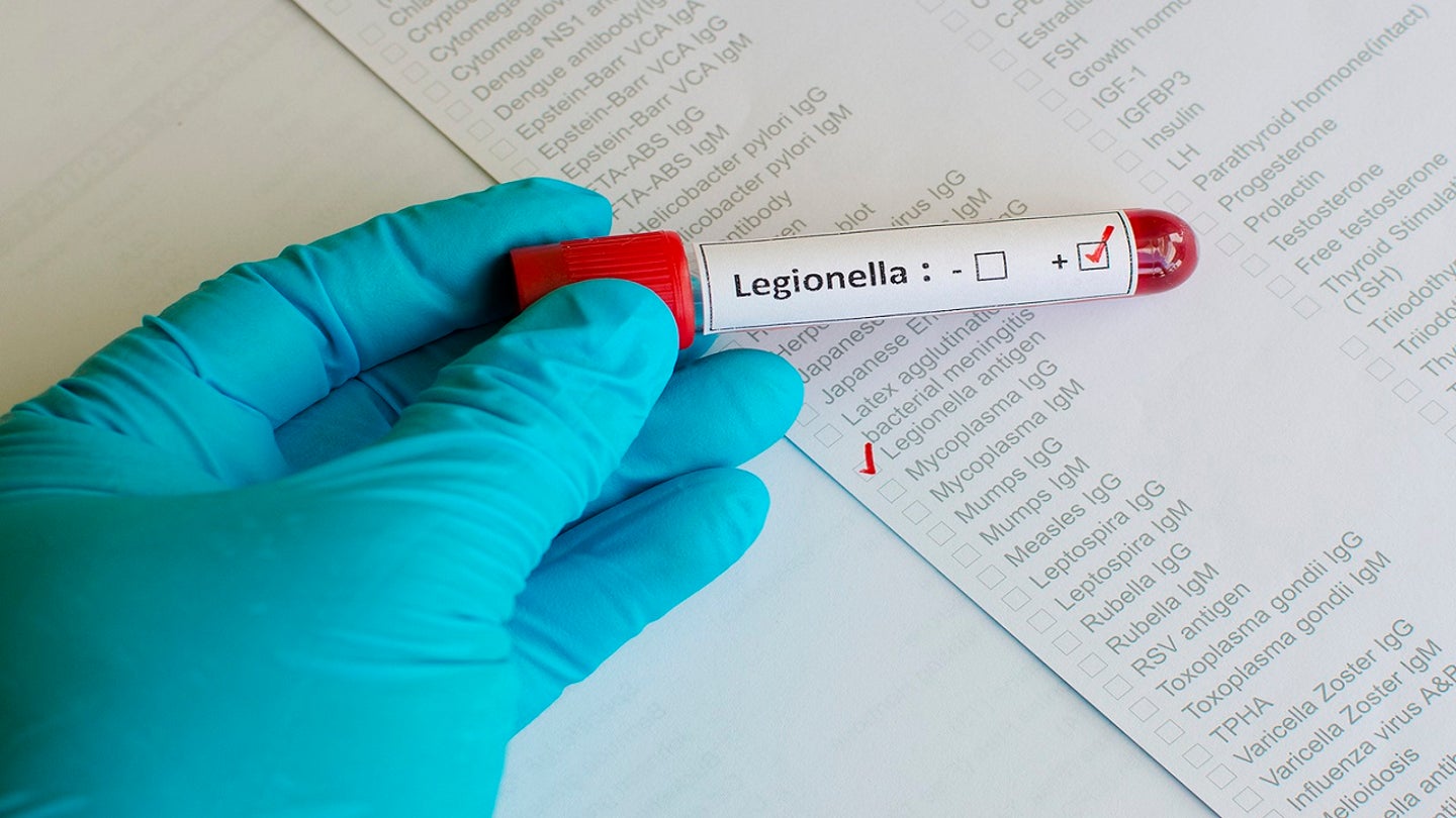 legionnaires disease