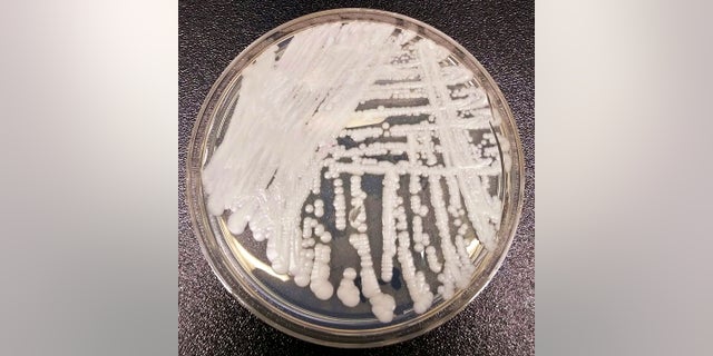 An image showing a Petri dish with bacteria.