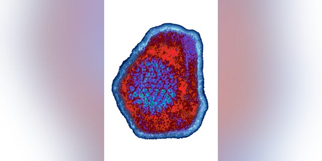 Herpesvirus Herpesvirus Simiae or Monkey B Virus causes fatal encephalomyelitis.  Image taken from a view under a transmission electron microscope, virus diameter 180 Nm.  (Photo by BSIP / UIG via Getty Images)