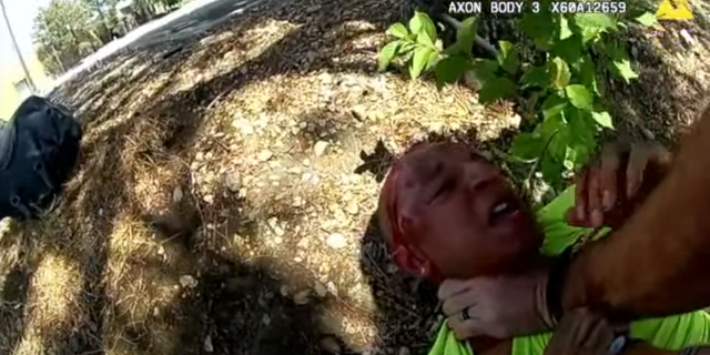 Kyle Vinson had to receive six stitches to a cut on his face after the arrest.