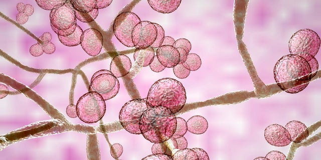 Candida aurist was reported in the U.S. in 2016 and cases have climbed ever since.