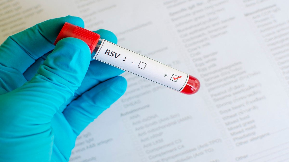 RSV sample