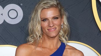 Ben Affleck's ex-girlfriend Lindsay Shookus proudly reveals birthmark covering her entire leg