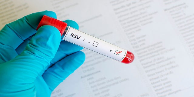 Blood sample indicating respiratory syncytial virus (RSV). "Rates are higher now than they were even compared to fall of 2021, when there was an unusual pattern of RSV circulation," a CDC spokesperson said. 