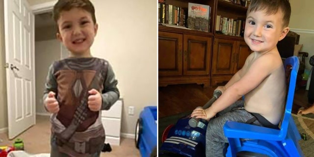 Jameson Nance had suffered from multiple injuries from alleged child abuse before he died, authorities said.
