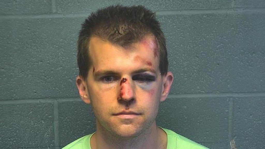 Dad brutally beats pastor accused of inappropriately touching son at bus stop