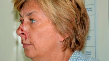 Amnesiac woman found bloodied and with no ID in Croatia was once a Hollywood jewelry designer