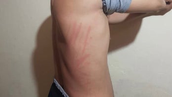 Afghan interpreter beaten, tortured by Taliban in front of family as his SIV application lags