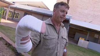 Australian man ‘a bit sore’ after hand was caught in croc’s jaws