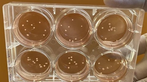 Lab-grown mini brains mimic Parkinson’s disease, researchers say