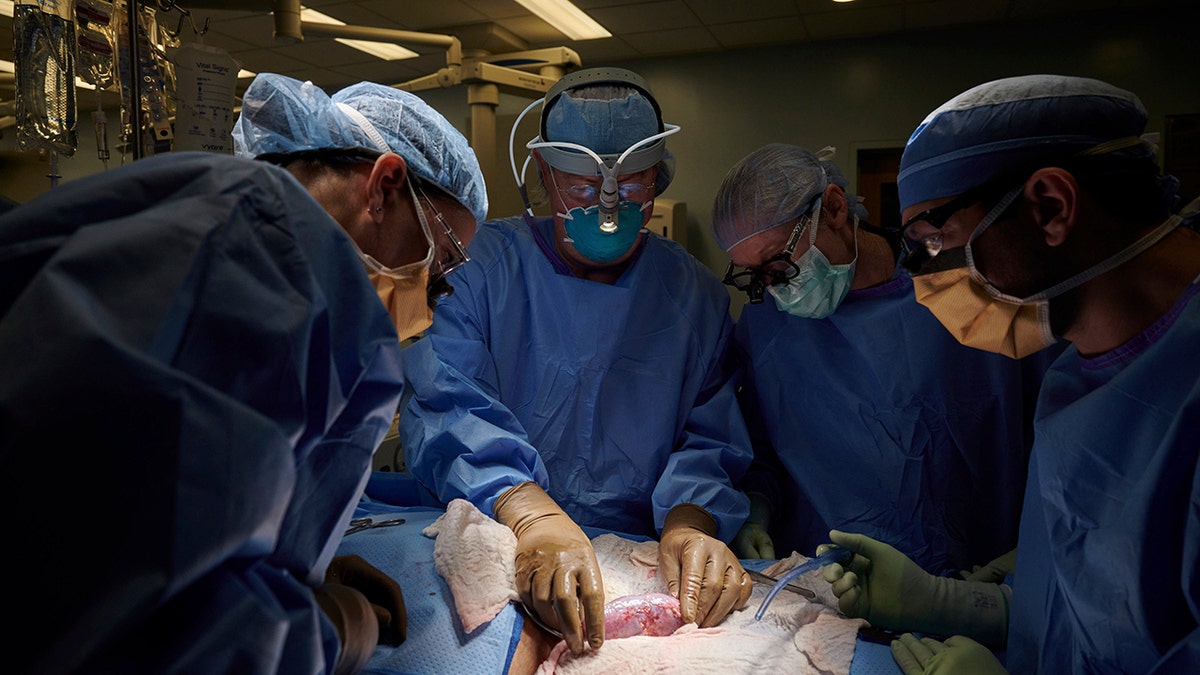 In this September 2021 photo provided by NYU Langone Health, a surgical team at the hospital in New York examines a pig kidney attached to the body of a deceased recipient for any signs of rejection. (Joe Carrotta/NYU Langone Health via AP)