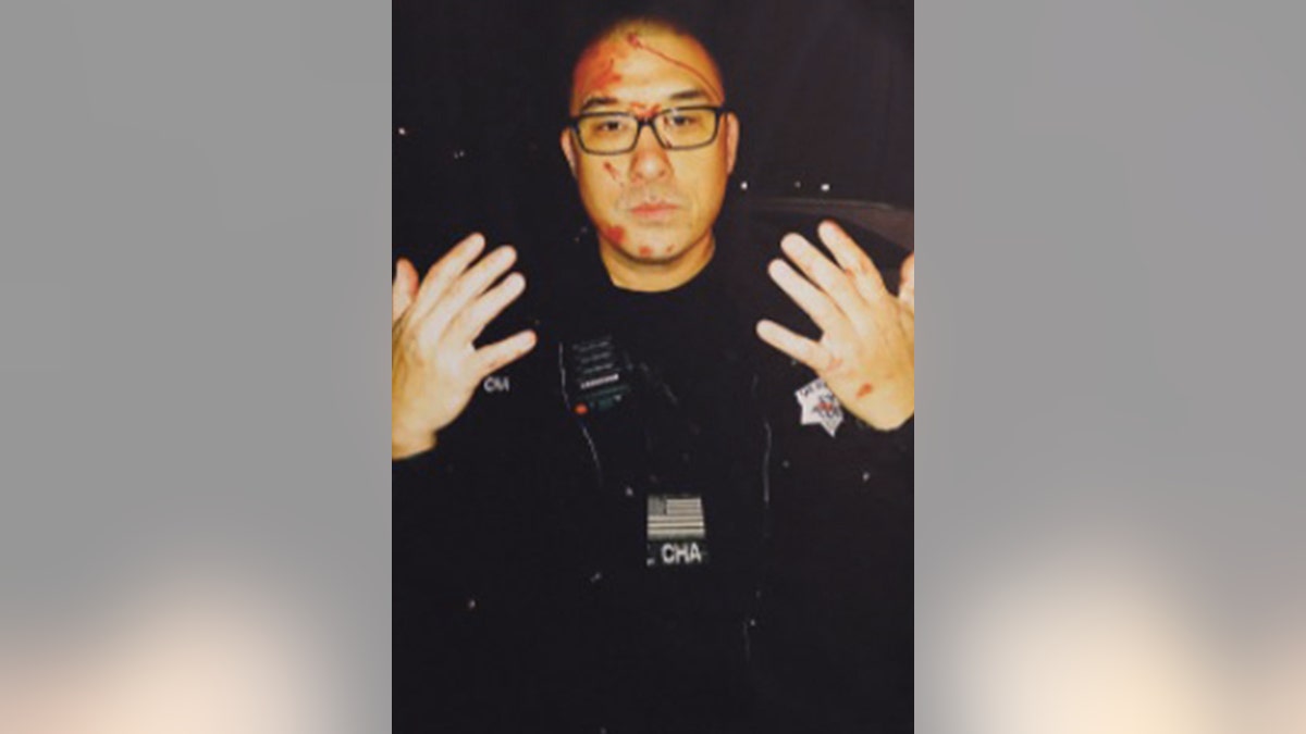 Officer Kenneth Cha was involved in both of San Francisco's only two police shootings in 2017, according to the public defender's office. Here, Cha displays injuries allegedly sustained in a Jan. 6 confrontation with a mentally ill man at his Ocean View home that ended in Cha shooting and seriously injuring the man. He was charged Tuesday with voluntary manslaughter after a man died from his injuries, District Attorney Chesa Boudin announced (Photo By Liz Hafalia/The San Francisco Chronicle via Getty Images)