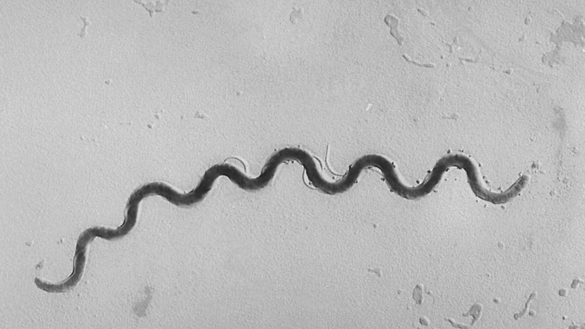 This 1972 microscope image provided by the Centers for Disease Control and Prevention shows a Treponema pallidum bacterium which causes the disease syphilis.