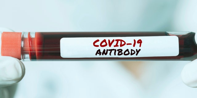 US government plans to purchase large supply of COVID-19 treatment sotrovimab for winter surge