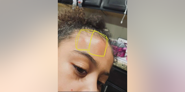 Mia went home from school with a lump on her head that she says came from being shoved into a wall.