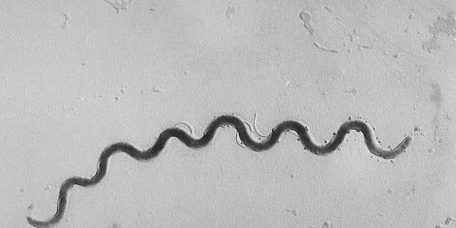Esta imagem microscópica de 1972 fornecida pelos Centros de Controle e Prevenção de Doenças mostra uma bactéria Treponema pallidum que causa a sífilis.