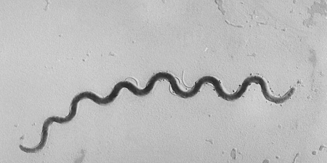 Esta imagem microscópica de 1972 fornecida pelos Centros de Controle e Prevenção de Doenças mostra uma bactéria Treponema pallidum que causa a sífilis.