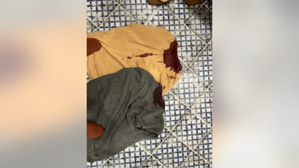 A father and his baby daughter were attacked Sunday by a man with bricks, police said.