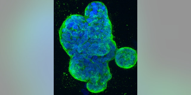This photo provided by the National Institutes of Health shows a three-dimensional culture of human breast cancer cells, with DNA stained blue and a protein in the cell surface membrane stained green. (National Institutes of Health via AP)