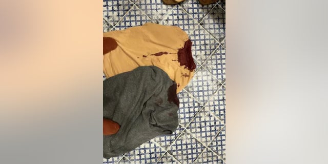 A father and his baby daughter were attacked Sunday by a man with bricks, police said.