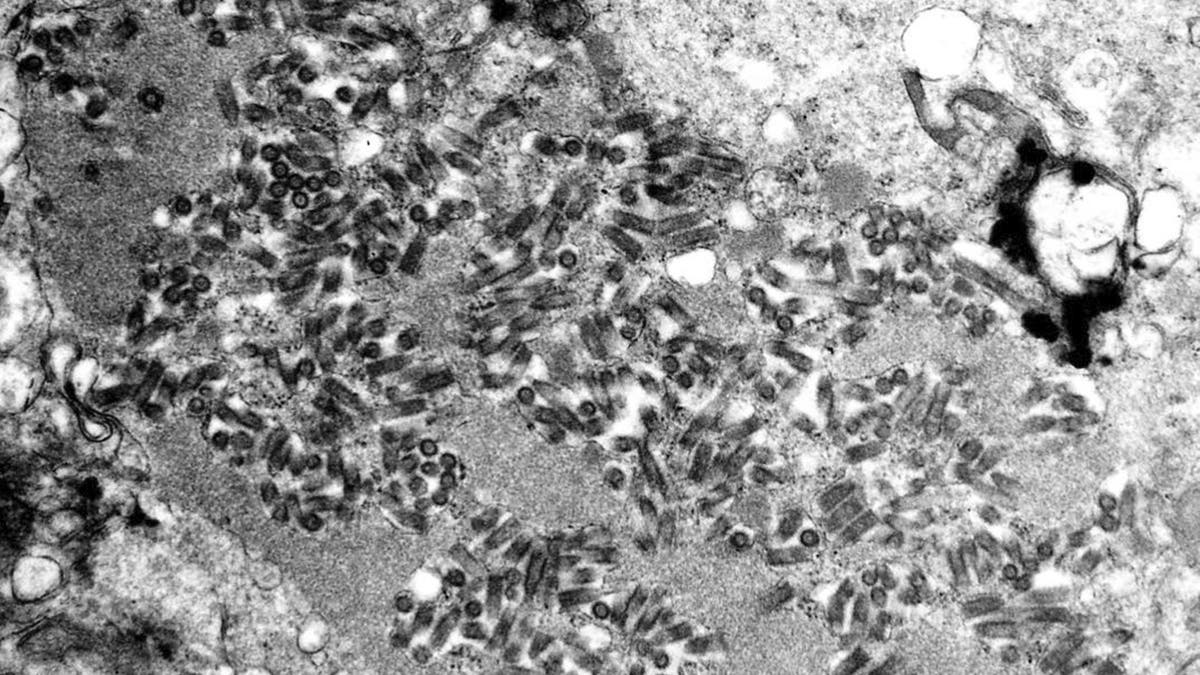 This undated electron microscope image made available by the Centers for Disease Control and Prevention shows rabies virions, dark and bullet-shaped, within an infected tissue sample. (F. A. Murphy/CDC via AP)