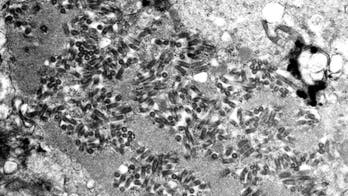 US reports highest number of rabies deaths in a decade