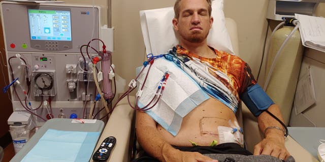 Shamgar Connors has been diagnosed with Stage 5 focal segmental glomerulosclerosis.