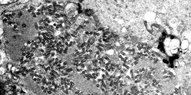 Esta imagem de microscópio eletrônico sem data disponibilizada pelos Centros de Controle e Prevenção de Doenças mostra vírions da raiva, escuros e em forma de bala, dentro de uma amostra de tecido infectado.  (FA Murphy/CDC via AP)