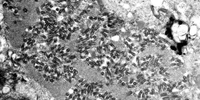 This undated electron microscope image made available by the Centers for Disease Control and Prevention shows rabies virions, dark and bullet-shaped, within an infected tissue sample. (F. A. Murphy/CDC via AP)