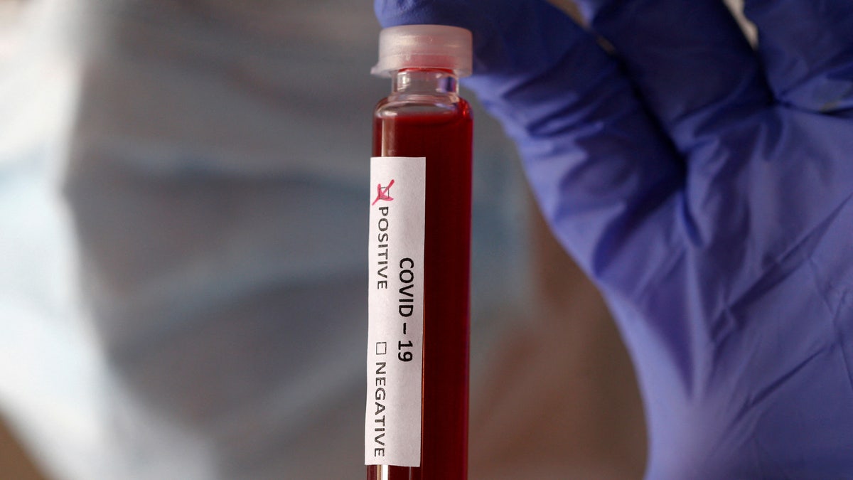 Fake blood is seen in test tubes labelled with the coronavirus (COVID-19) in this illustration taken March 17, 2020. 