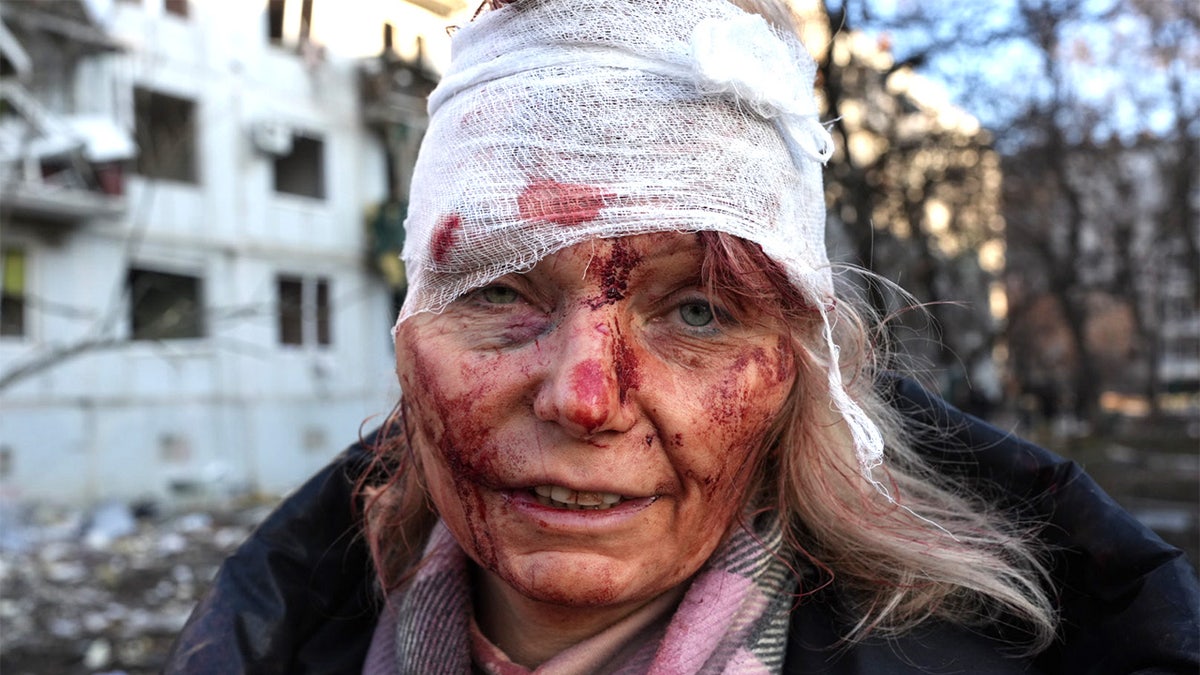 A wounded woman is seen as airstrike damages an apartment complex outside of Kharkiv, Ukraine, on Feb. 24, 2022.