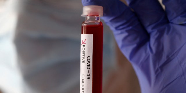 Fake blood is seen in test tubes labelled with the coronavirus (COVID-19) in this illustration taken March 17, 2020. 