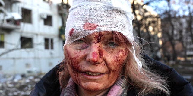 A wounded woman is seen as airstrike damages an apartment complex outside of Kharkiv, Ukraine, on Feb. 24, 2022.