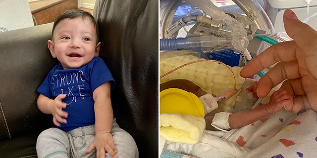 Doctors said baby Jari Lopez had a 30% survival rate after concerns of fetal growthrestriction combined with mom Amber Higgins’ preeclampsia diagnosis.