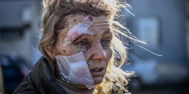 An injured woman stands in front of a hospital after the shelling of the eastern Ukrainian city of Chuguiv on February 24, 2022.