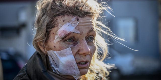 A wounded woman stands outside a hospital after the bombing of the eastern Ukraine town of Chuguiv on Feb. 24, 2022.