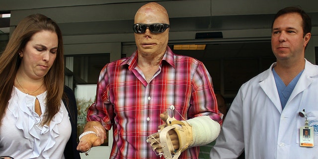 Joe Kinan was discharged from Massachusetts General Hospital after receiving a hand transplant. It was the first procedure of its kind at the Massachusetts General Hospital Hand Transplantation Service. Kinan was severely burned in the Station nightclub fire. 