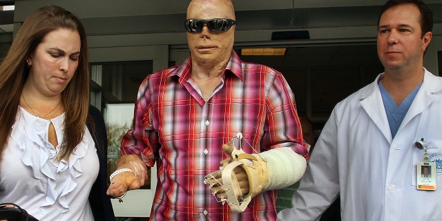 Joe Kinan was discharged from Massachusetts General Hospital after receiving a hand transplant. It was the first procedure of its kind at the Massachusetts General Hospital Hand Transplantation Service. Kinan was severely burned in the Station nightclub fire.