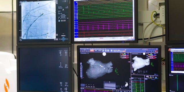 Radiofrequency ablation of cardiac arrhythmia using the Stereotaxis robotic system, by inserting a catheter into the heart, emitting radio waves that will cauterize cardiac tissue responsible for rhythmic irregularity. (Photo by: BSIP/Universal Images Group via Getty Images)