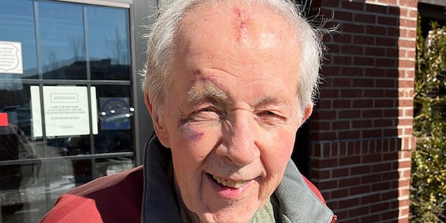 Another view of Marine veteran Ed Norton, with the facial bruises and cuts from his fall.  He believes the masks that so many Americans have had to wear have been 