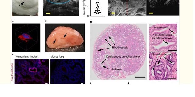 Exhibit from NIH-funded study utilizing fetal lungs. Figure A shows implanted lung tissue.