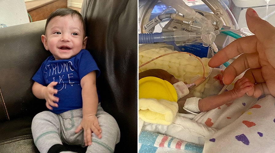 Baby born weighing less than 1 pound released from Arizona hospital after nearly five months