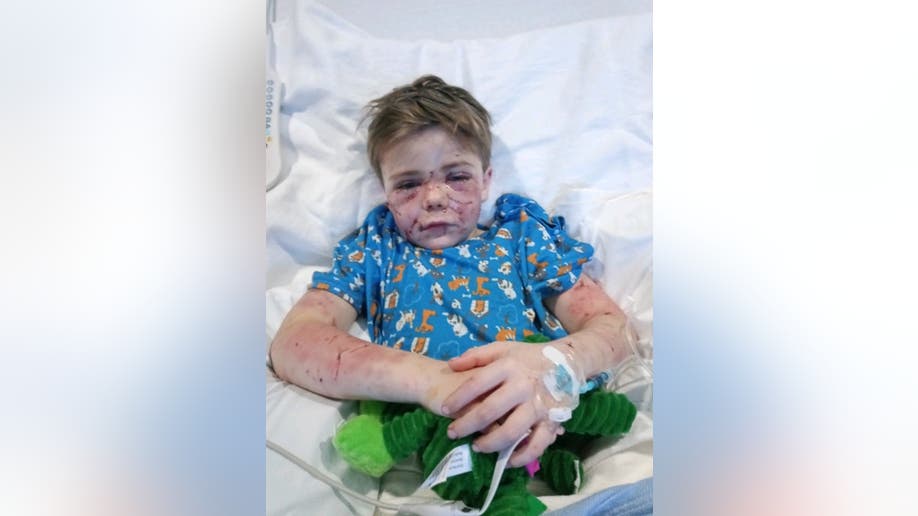 Connor had to have more than three hours of reconstructive surgery after the dog attack. 