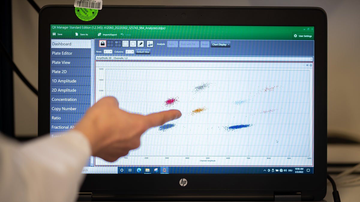 A sample analysis of a wastewater sample with evidence of viral genes of the SARS-CoV-2 virus can be seen on a monitor in a laboratory at the Institute of Hygiene and Health on March 3, 2022 in Hamburg, Germany. In a model project, the concentration of SARS-CoV-2 is to be monitored in wastewater over a period of one year.