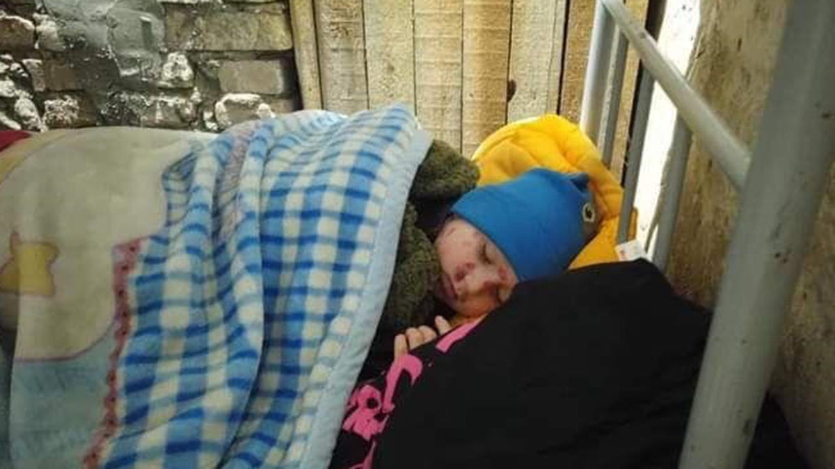 An injured child in Ukraine 