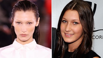 Yolanda Hadid faces backlash for allowing supermodel daughter Bella to get a nose job at age 14