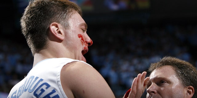 North Carolina's Tyler Hansbrough bleeds after a flagrant foul by Duke's Gerald Henderson (not pictured) during the final 14.5 seconds of the Tar Heels' 86-72 win March 4, 2007, at the Dean E. Smith Center in Chapel Hill, N.C.