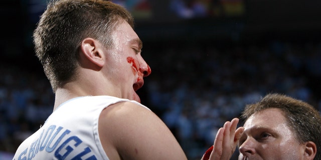 North Carolina's Tyler Hansbrough bleeds after a flagrant foul by Duke's Gerald Henderson (not pictured) during the final 14.5 seconds of the Tar Heels' 86-72 win March 4, 2007, at the Dean E. Smith Center in Chapel Hill, N.C.