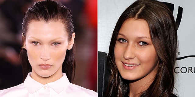 Bella Hadid says she regrets undergoing the knife to fix her nose at the age of 14.